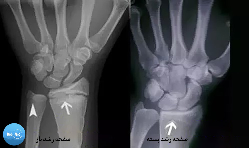 صفحه رشدهای باز و بسته