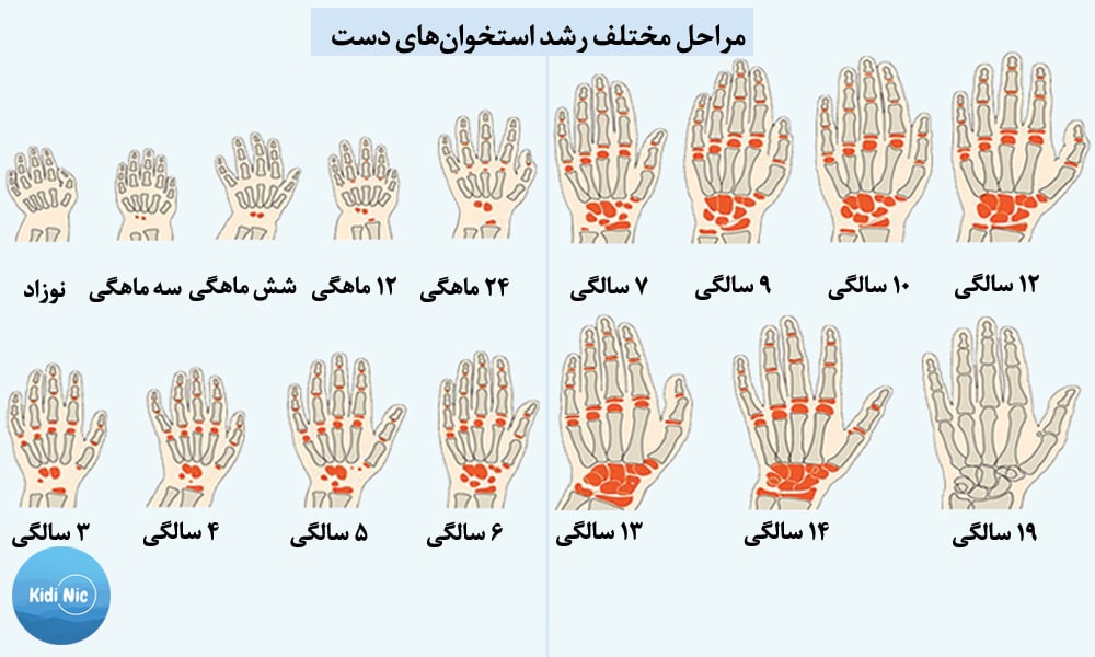 تعیین سن استخوانی