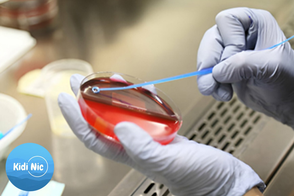 آزمایش کشت ادرار (Urine Culture) 