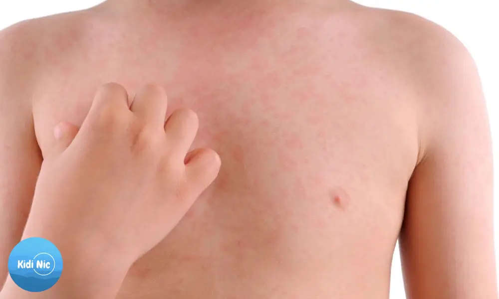 واکنش به واکسن