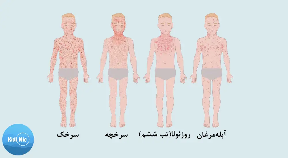 بیماری ویروسی 