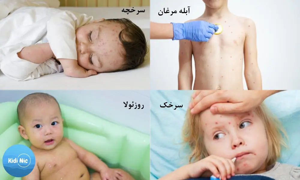 بیماری ویروسی 